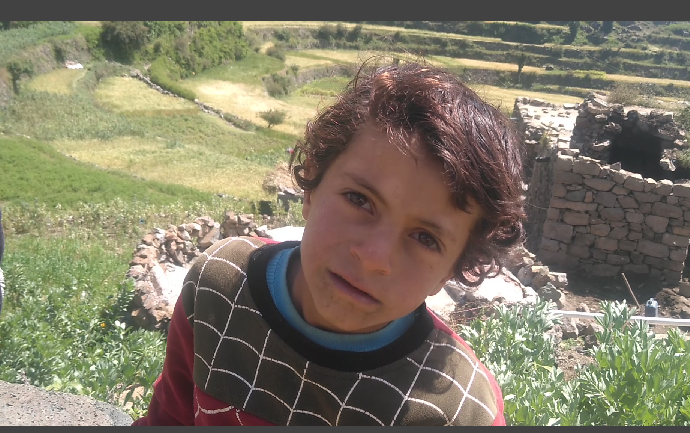 الزراعة والجوع